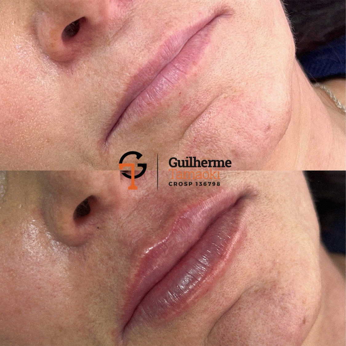 protese-03 copiar 12