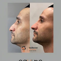 Harmonização de perfil